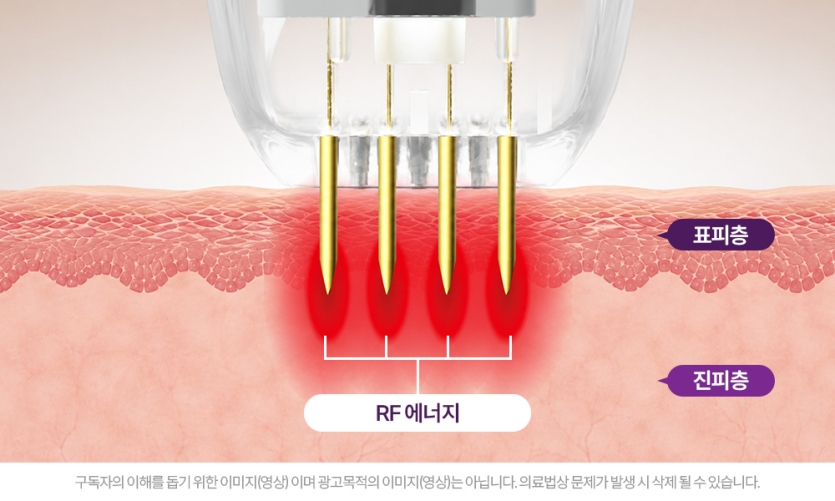 4ecb4-6a339c938a571-5c278f4b714280420c42318de299e96efbe9857a.jpg