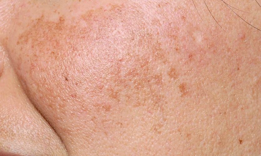 4ecb4-6a3a0174ce396-7a1810474948c527b03078105eb77979b19bb290.jpg