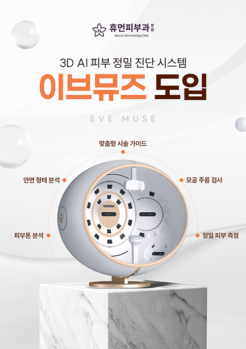 이브뮤즈 도입