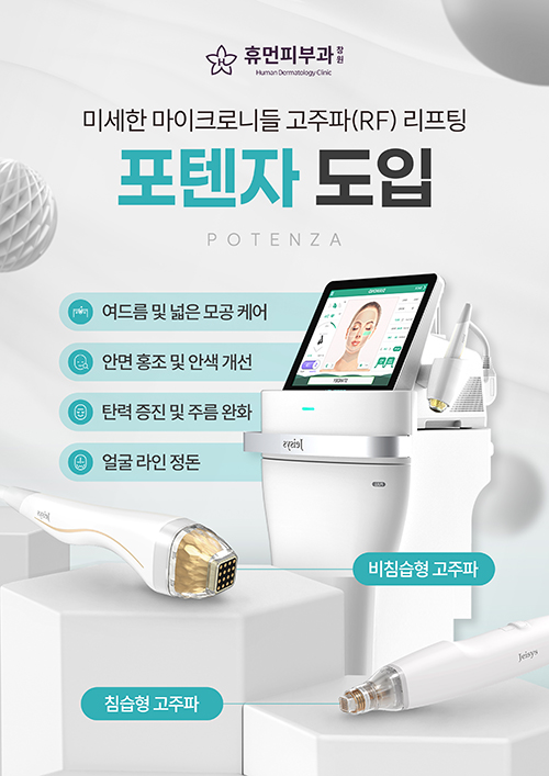 포텐자 도입